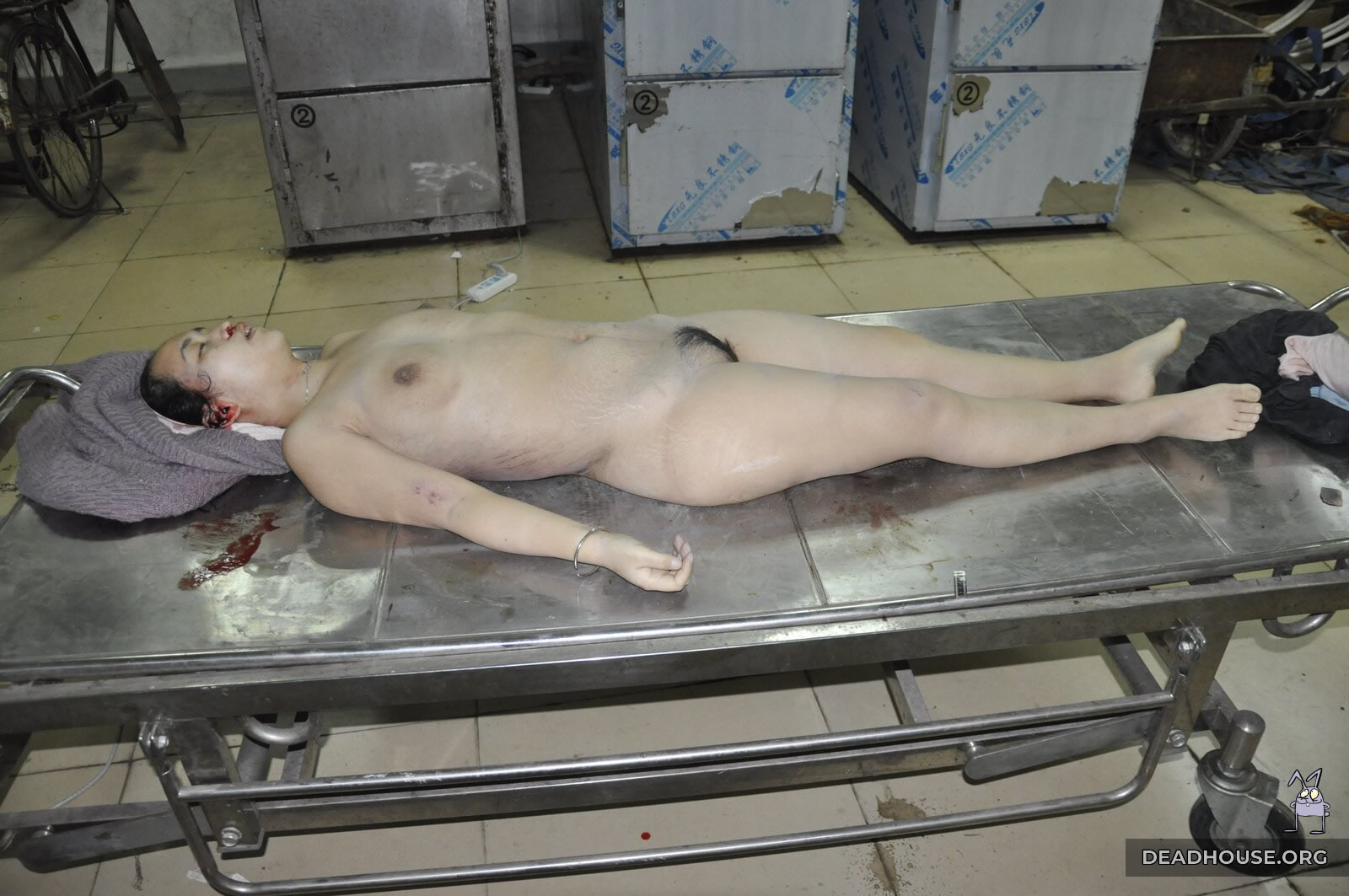 naked male corpse 